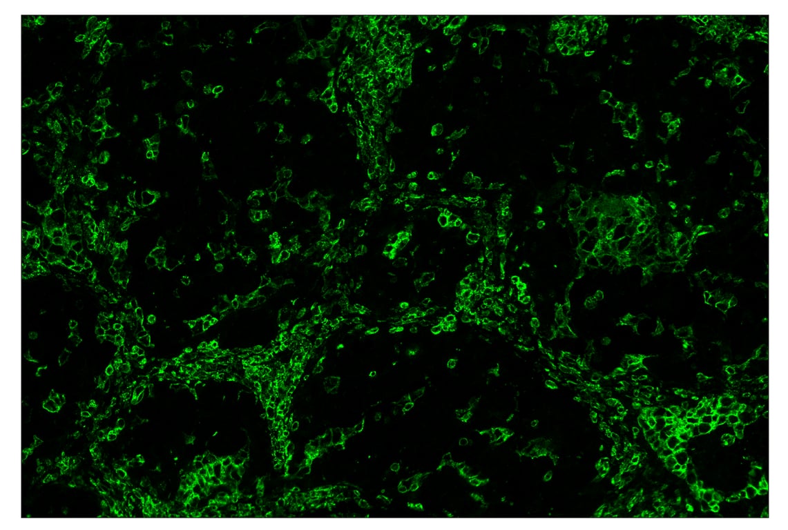 Immunohistochemistry Image 2: CD45 (Intracellular Domain) (D9M8I) & CO-0013-750 SignalStar<sup>™</sup> Oligo-Antibody Pair