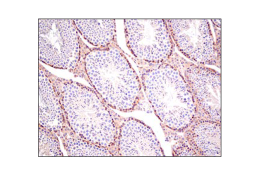 Immunohistochemistry Image 4: PLCγ1 (D9H10) XP<sup>®</sup> Rabbit mAb (BSA and Azide Free)