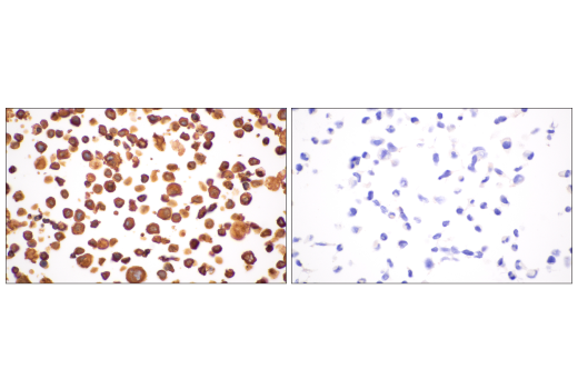 Immunohistochemistry Image 19: p22phox (E7Y1F) XP<sup>®</sup> Rabbit mAb