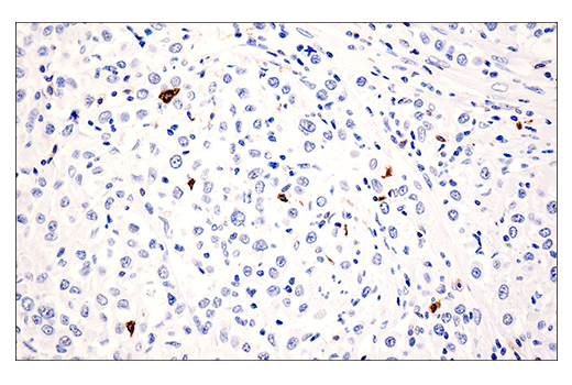 Immunohistochemistry Image 1: CD20 (E7B7T) XP<sup>®</sup> Rabbit mAb