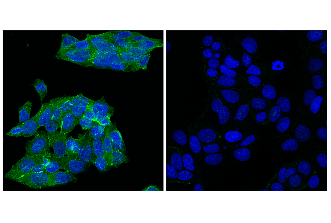 Immunofluorescence Image 1: Angiomotin (D2O4H) Rabbit mAb