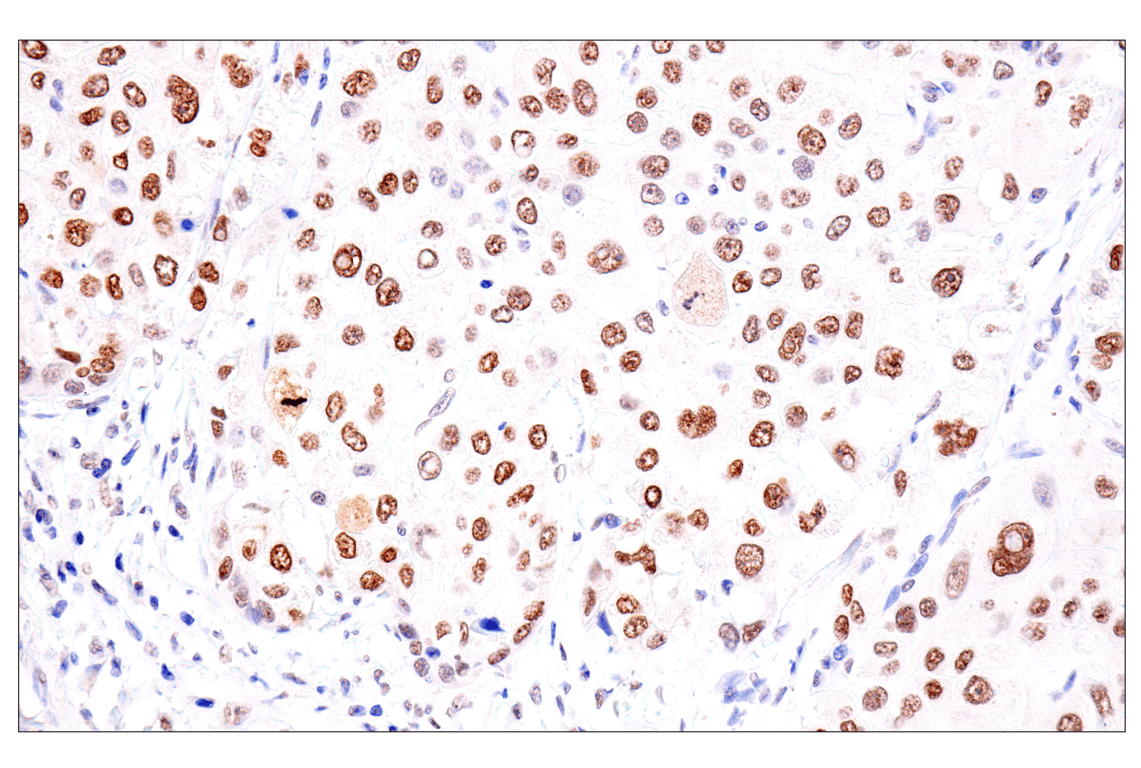 Immunohistochemistry Image 7: FoxA1/HNF3α (IHC578) Mouse mAb