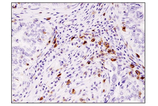 Immunohistochemistry Image 1: ICOS (D1K2T<sup>™</sup>) Rabbit mAb