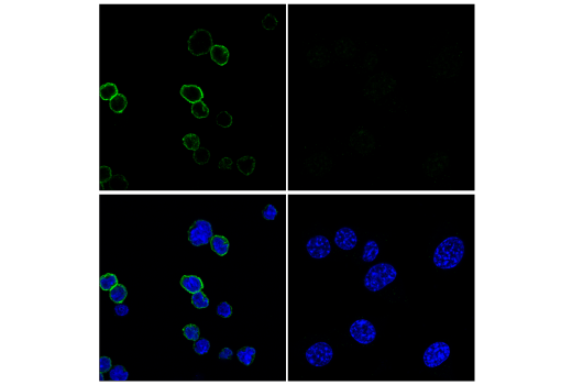 Immunofluorescence Image 1: TACI/TNFRSF13B/CD267 (E3P6X) Rabbit mAb