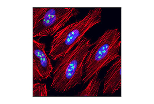 Immunofluorescence Image 1: eIF6 (D16E9) XP<sup>®</sup> Rabbit mAb