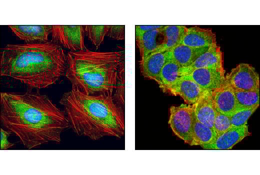 Immunofluorescence Image 1: eIF4H (D85F2) XP<sup>®</sup> Rabbit mAb