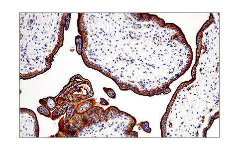 Immunohistochemistry Image 3: CD200 (E5I9V) XP<sup>®</sup> Rabbit mAb (BSA and Azide Free)