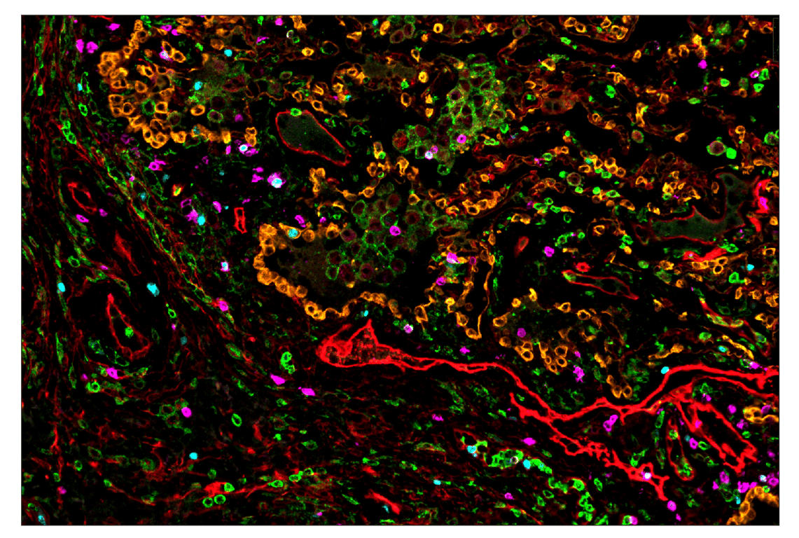 Immunohistochemistry Image 1: CD11b/ITGAM (D6X1N) & CO-0037-750 SignalStar<sup>™</sup> Oligo-Antibody Pair