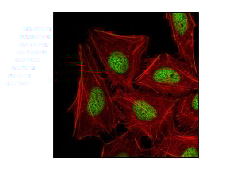 Immunofluorescence Image 1: Di-Methyl-Histone H3 (Lys27) (D18C8) XP<sup>®</sup> Rabbit mAb
