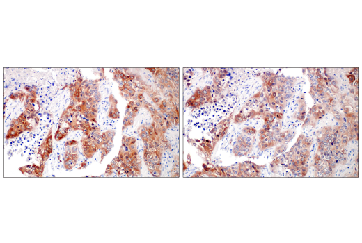 Immunohistochemistry Image 7: Asparagine Synthetase (E6C2C) XP<sup>®</sup> Rabbit mAb (BSA and Azide Free)