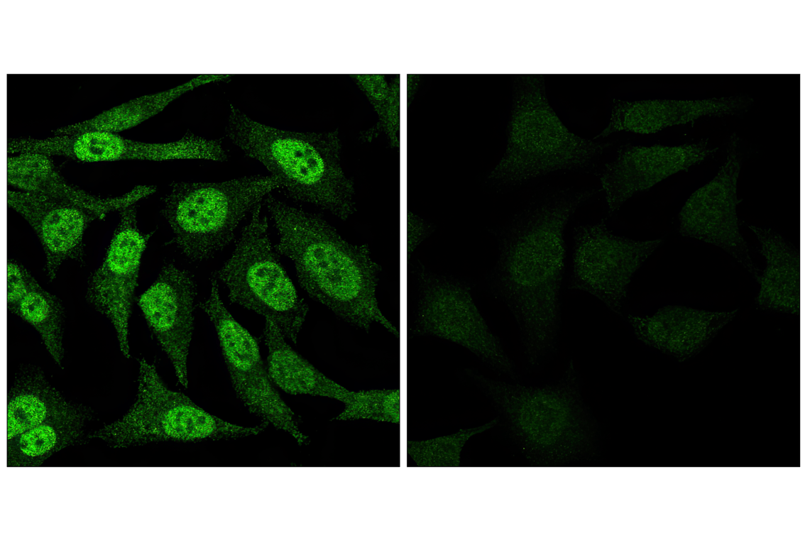 undefined Image 31: Stat3/Stat5 Signaling Antibody Sampler Kit