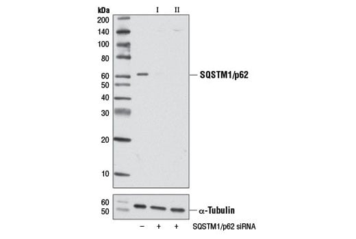 undefined Image 1: SignalSilence<sup>®</sup> SQSTM1/p62 siRNA I