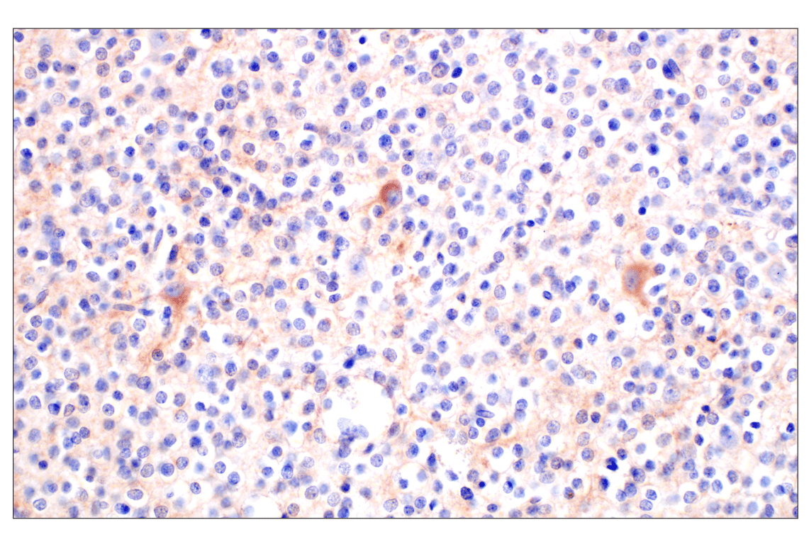 Immunohistochemistry Image 2: BACE1 (F4Z7X) Rabbit mAb (BSA and Azide Free)