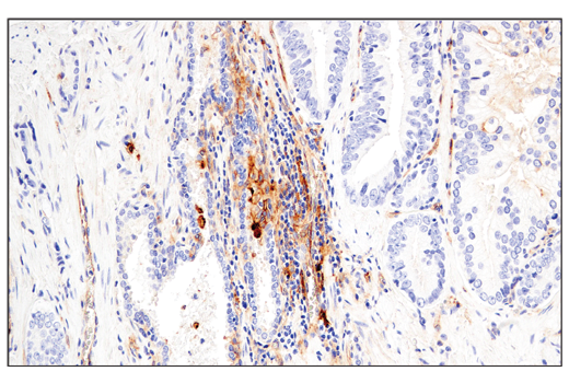 Immunohistochemistry Image 3: CD54/ICAM-1 (E3Q9N) XP<sup>®</sup> Rabbit mAb (BSA and Azide Free)