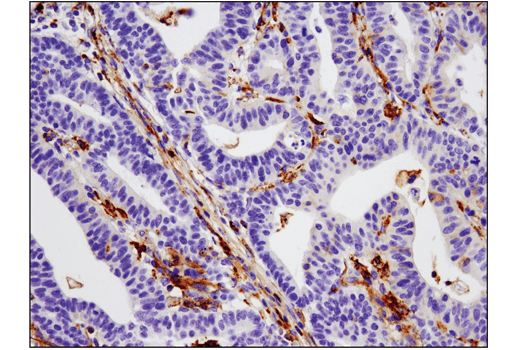 Immunohistochemistry Image 1: VISTA (D1L2G<sup>™</sup>) XP<sup>®</sup> Rabbit mAb (BSA and Azide Free)