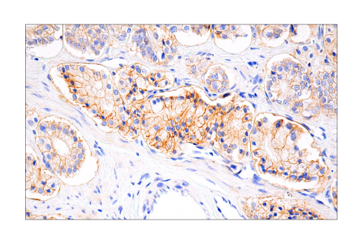 undefined Image 58: Lung Cancer RTK Antibody Sampler Kit