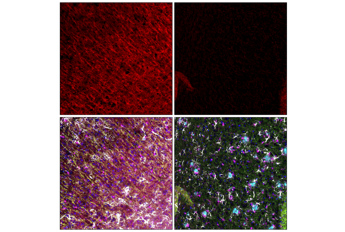 undefined Image 17: Demyelinating Disease Targets Antibody Sampler Kit