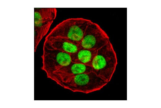 undefined Image 9: PhosphoPlus<sup>®</sup> p53 (Ser15) Antibody Duet