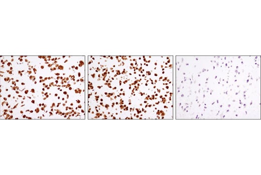 Immunohistochemistry Image 3: GSK-3β (D5C5Z) XP<sup>®</sup> Rabbit mAb (BSA and Azide Free)