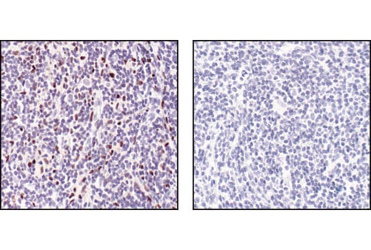 Immunohistochemistry Image 2: PU.1 (9G7) Rabbit mAb