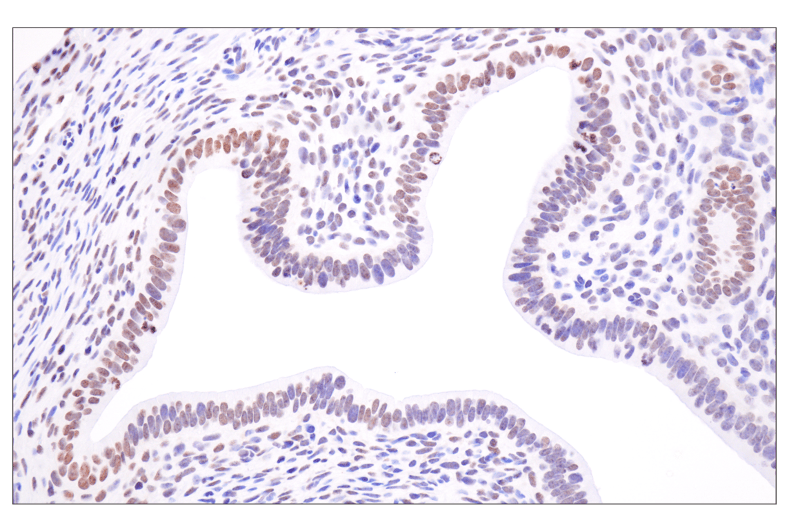 Immunohistochemistry Image 12: Acetyl-Histone H4 (Lys16) (E2B8W) Rabbit mAb