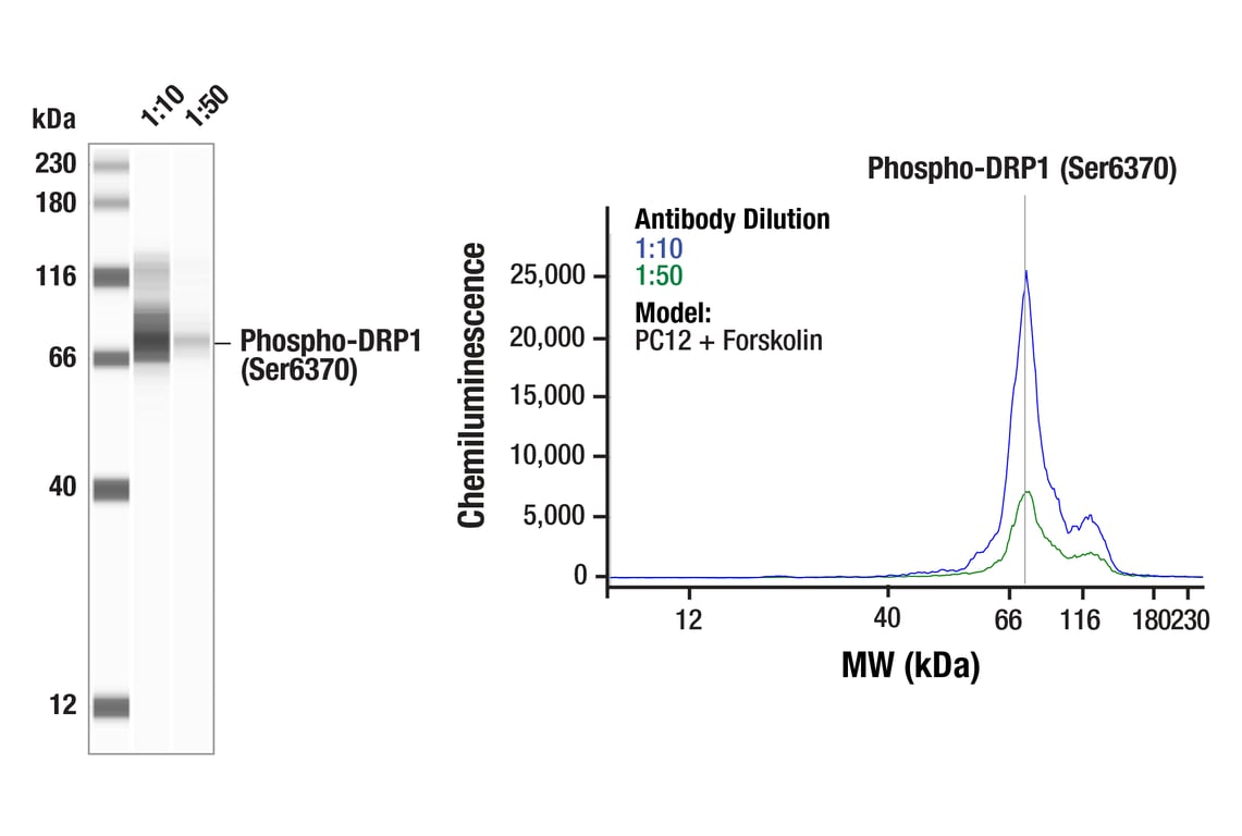 Western Blotting Image 1: Phospho-DRP1 (Ser637) (D3A4) Rabbit mAb
