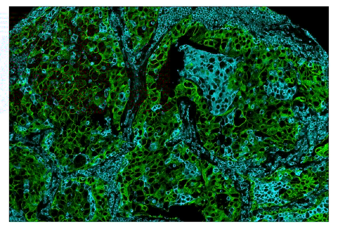 Immunohistochemistry Image 7: CD45 (Intracellular Domain) (D9M8I) & CO-0013-647 SignalStar<sup>™</sup> Oligo-Antibody Pair