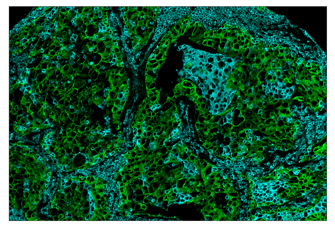 Immunohistochemistry Image 7: CD45 (Intracellular Domain) (D9M8I) & CO-0013-647 SignalStar<sup>™</sup> Oligo-Antibody Pair