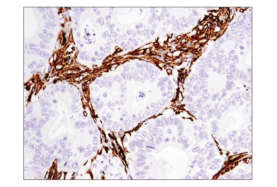 Immunohistochemistry Image 3: α-Smooth Muscle Actin (D4K9N) XP<sup>®</sup> Rabbit mAb (BSA and Azide Free)