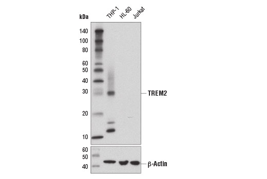 Western Blotting Image 2: TREM2 (D8I4C) Rabbit mAb (BSA and Azide Free)