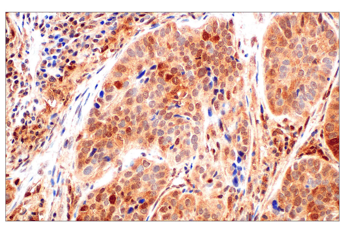 Immunohistochemistry Image 2: Stat3 (124H6) Mouse mAb