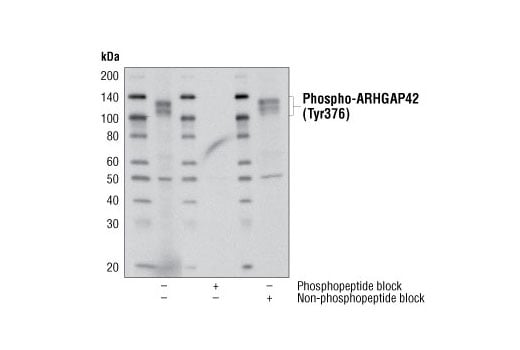 Western Blotting Image 1: Phospho-ARHGAP42 (Tyr376) (D45E9) Rabbit mAb