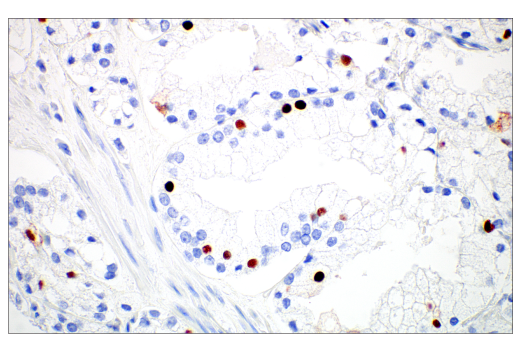 Immunohistochemistry Image 3: MAGE-C2/CT10 (E7B8D) XP<sup>®</sup> Rabbit mAb