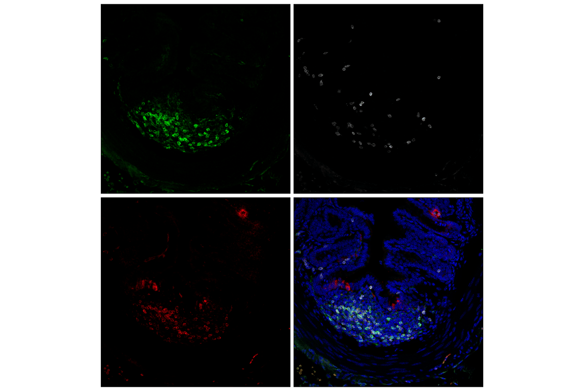 Immunofluorescence Image 1: CD22 (F9D1W) Rabbit mAb (BSA and Azide Free)