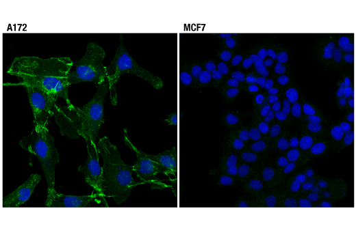 Immunofluorescence Image 1: N-Cadherin (D4R1H) XP<sup>®</sup> Rabbit mAb (BSA and Azide Free)