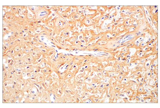 Immunohistochemistry Image 4: COL14A1 (E5W8S) Rabbit mAb (BSA and Azide Free)