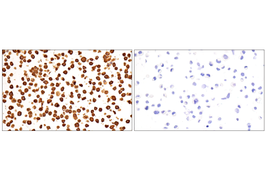 Immunohistochemistry Image 14: Galectin-3/LGALS3 (E7B6R) Rabbit mAb