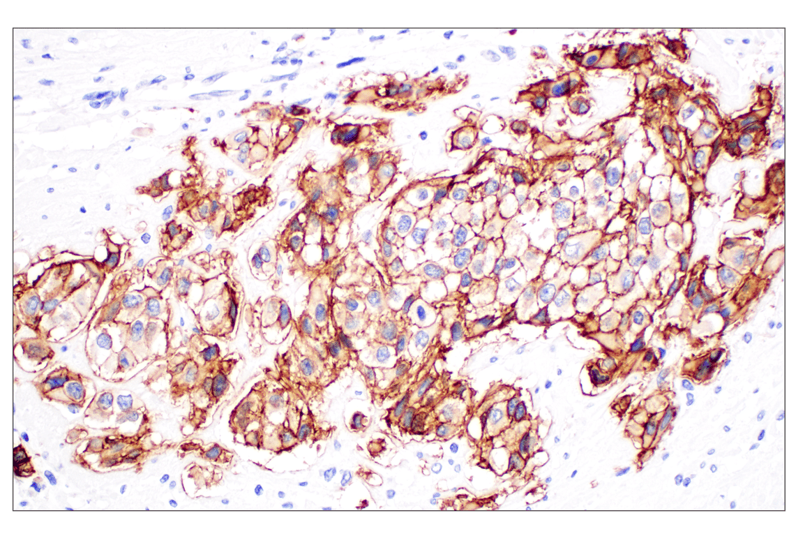 Immunohistochemistry Image 5: TACSTD2/TROP2 (F4W4J) Rabbit mAb (BSA and Azide Free)