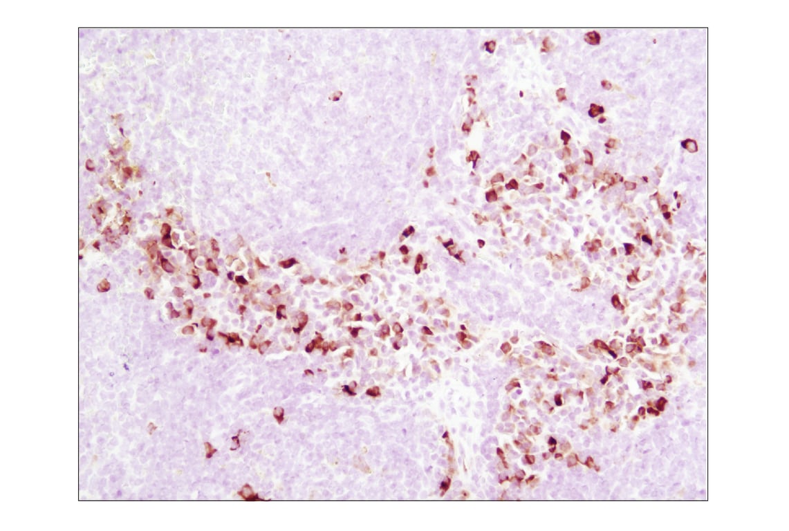 Immunohistochemistry Image 3: Phospho-S6 Ribosomal Protein (Ser235/236) (D57.2.2E) XP<sup>®</sup> Rabbit mAb (BSA and Azide Free)