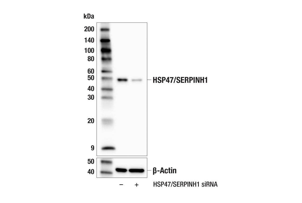 Western Blotting Image 2: HSP47/SERPINH1 (E4A8P) Rabbit mAb