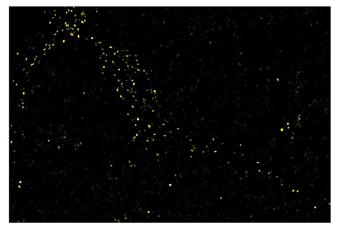 Immunohistochemistry Image 3: TCF1/TCF7 (C63D9) & CO-0006-750 SignalStar<sup>™</sup> Oligo-Antibody Pair