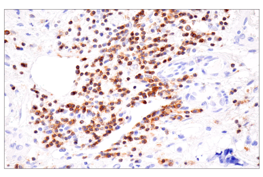 Immunohistochemistry Image 6: SLAMF6/CD352 (E3H1E) XP<sup>®</sup> Rabbit mAb