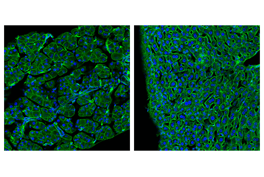 Immunofluorescence Image 2: Ras (E4K9L) Rabbit mAb (Alexa Fluor<sup>®</sup> 488 Conjugate)