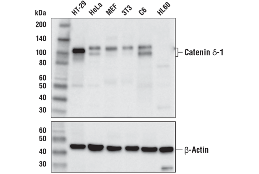 Western Blotting Image 1: Catenin δ-1 (D7S2M) XP<sup>®</sup> Rabbit mAb