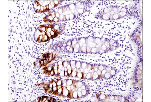 Immunohistochemistry Image 1: OLFM4 (D1E4M) XP<sup>®</sup> Rabbit mAb