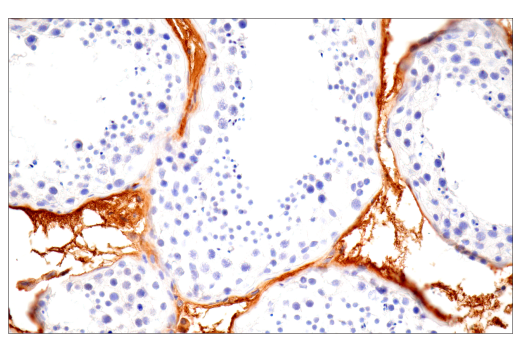 Immunohistochemistry Image 10: α-2-Macroglobulin (E6N7X) Rabbit mAb