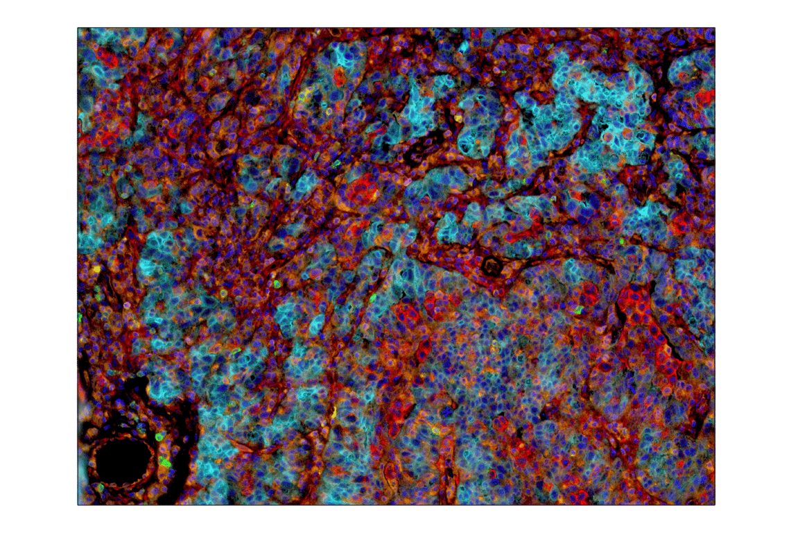Immunohistochemistry Image 7: VISTA (D1L2G<sup>™</sup>) XP<sup>®</sup> Rabbit mAb