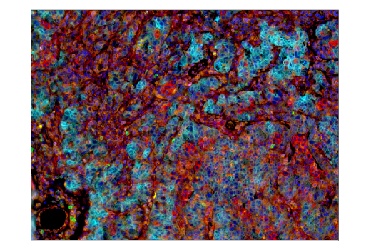 Immunohistochemistry Image 6: TIM-3 (D5D5R<sup>™</sup>) XP<sup>®</sup> Rabbit mAb (BSA and Azide Free)