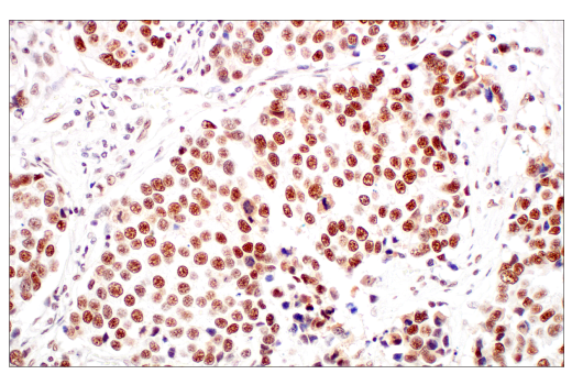 Immunohistochemistry Image 3: METTL3 (E3F2A) Rabbit mAb (BSA and Azide Free)