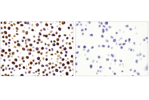 Immunohistochemistry Image 3: Myeloperoxidase (E1E7I) XP<sup>®</sup> Rabbit mAb